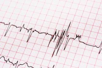 Ekg Kağıdı 5cm x 30mt