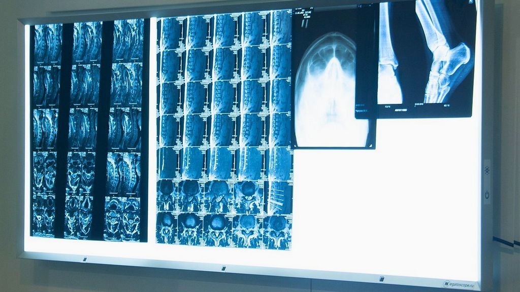 Negatoskop: Röntgen Filmlerinin Gizli Kahramanı